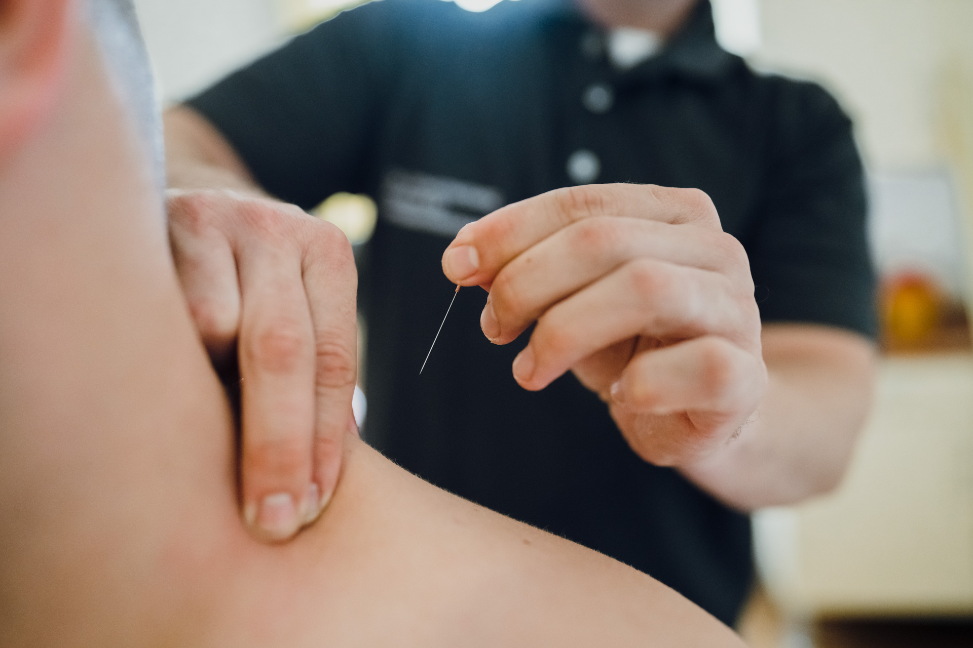 Triggerpunktakupunktur im Orthozentrum Bergstraße